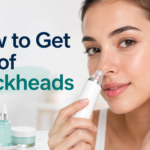 how to get rid of blackheads